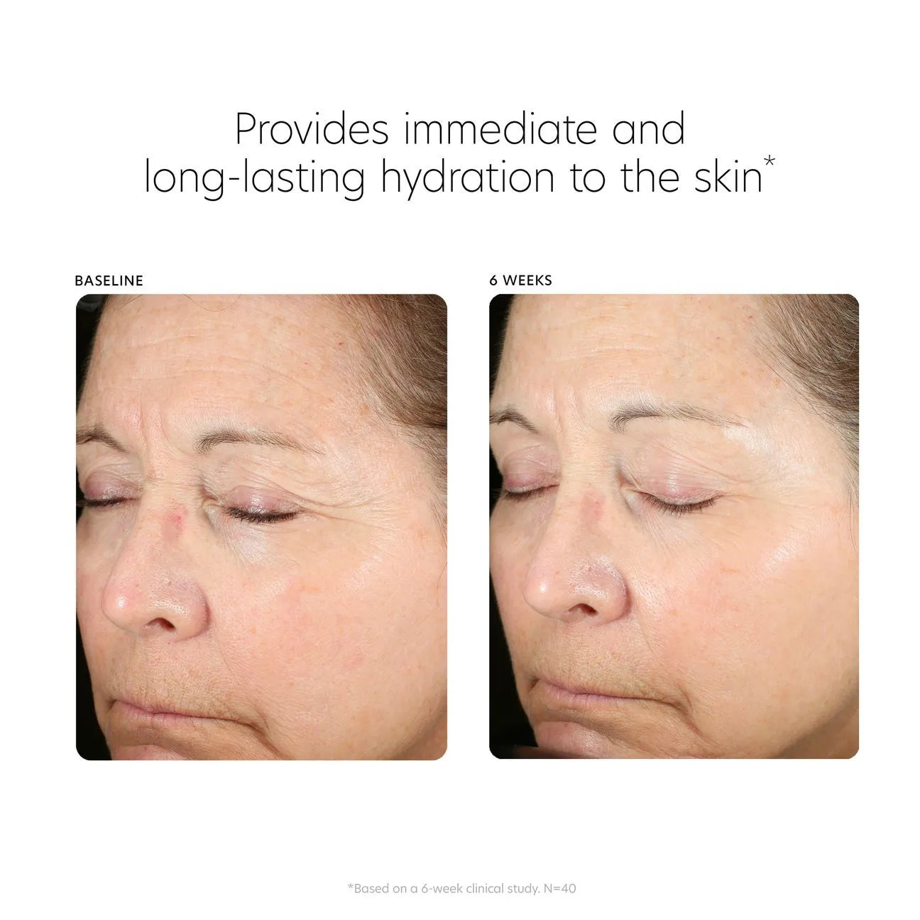 PCA Skin Hyaluronic Acid Boosting Serum 3 oz
