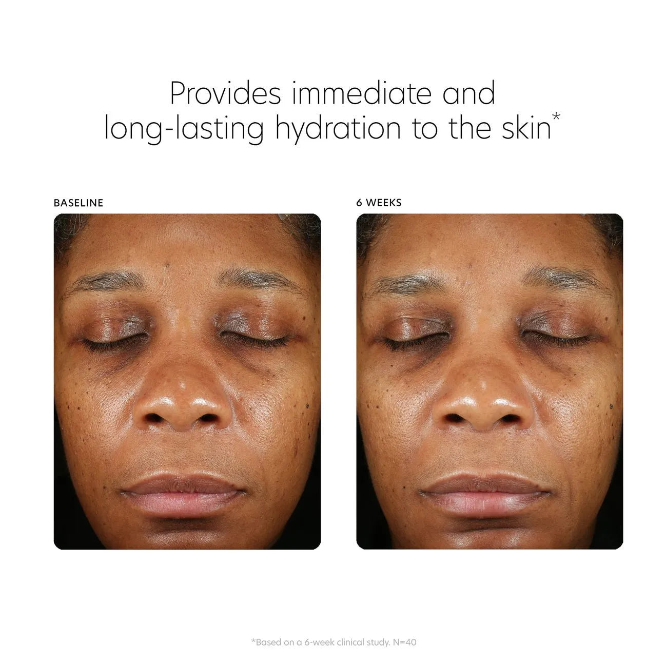 PCA Skin Hyaluronic Acid Boosting Serum 1 oz