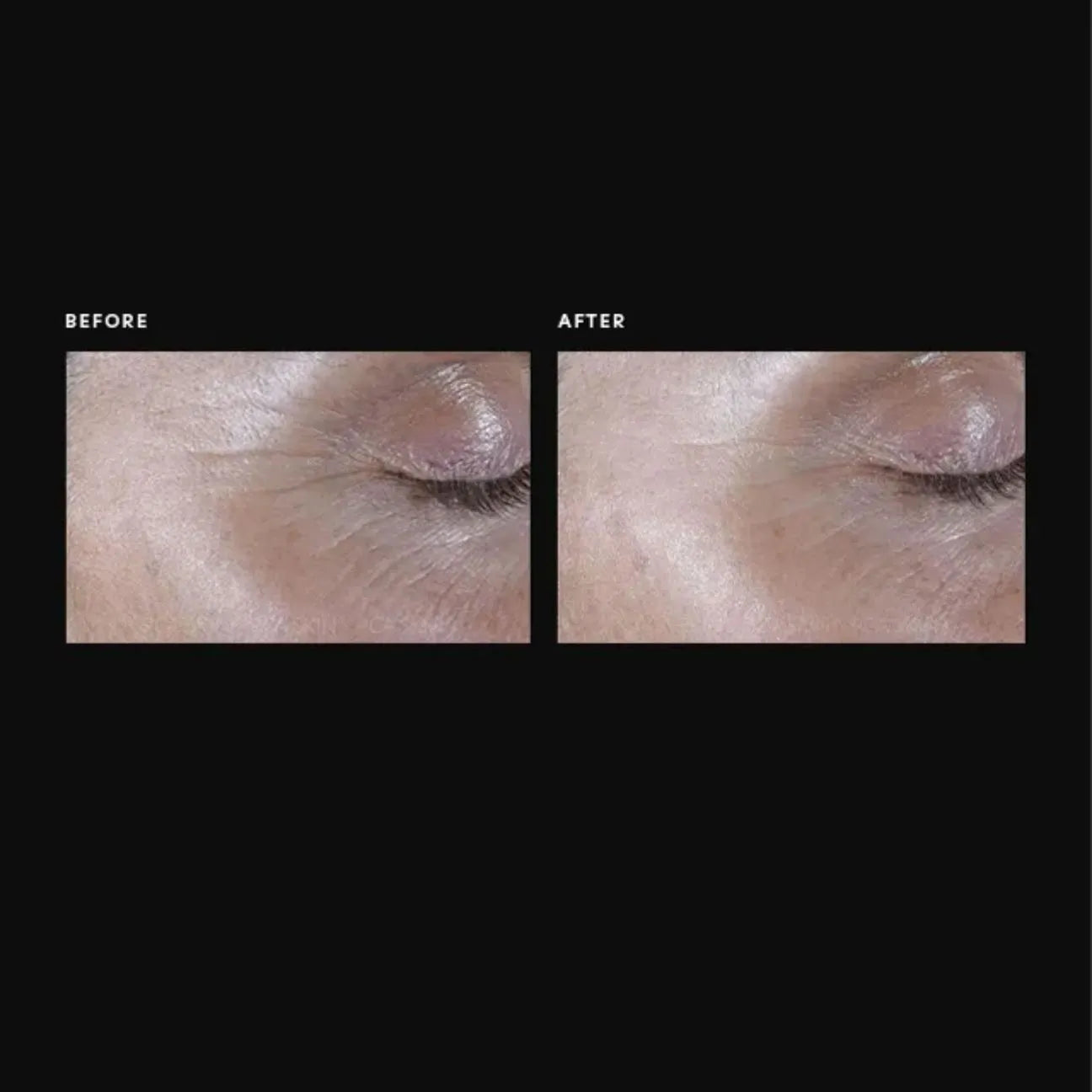 PCA Skin ExLinea Pro Peptide Serum 1 oz.