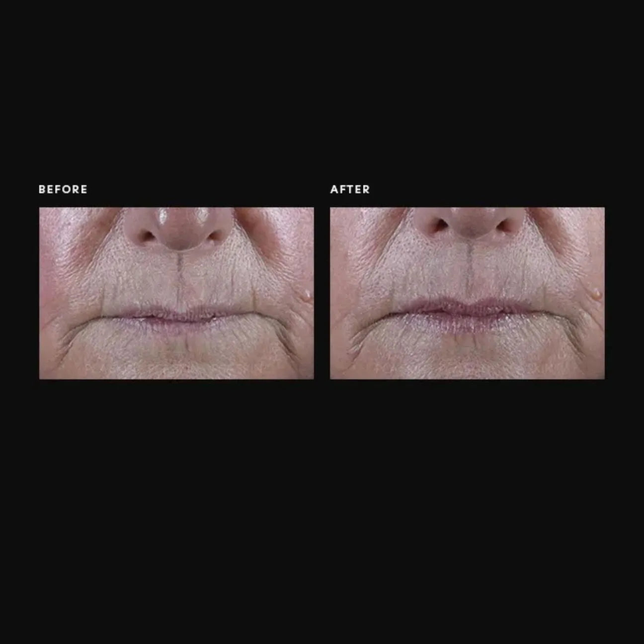 PCA Skin ExLinea Pro Peptide Serum 1 oz.