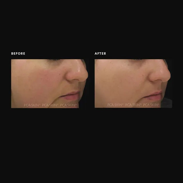 PCA Skin Dual Action Redness Relief 1 oz.