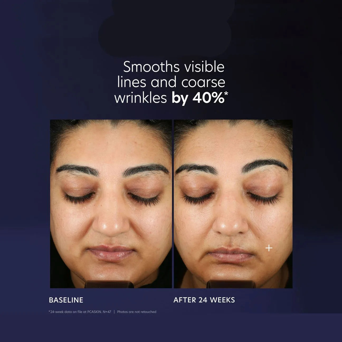 PCA Skin Pro-Max Age Renewal 1 oz.