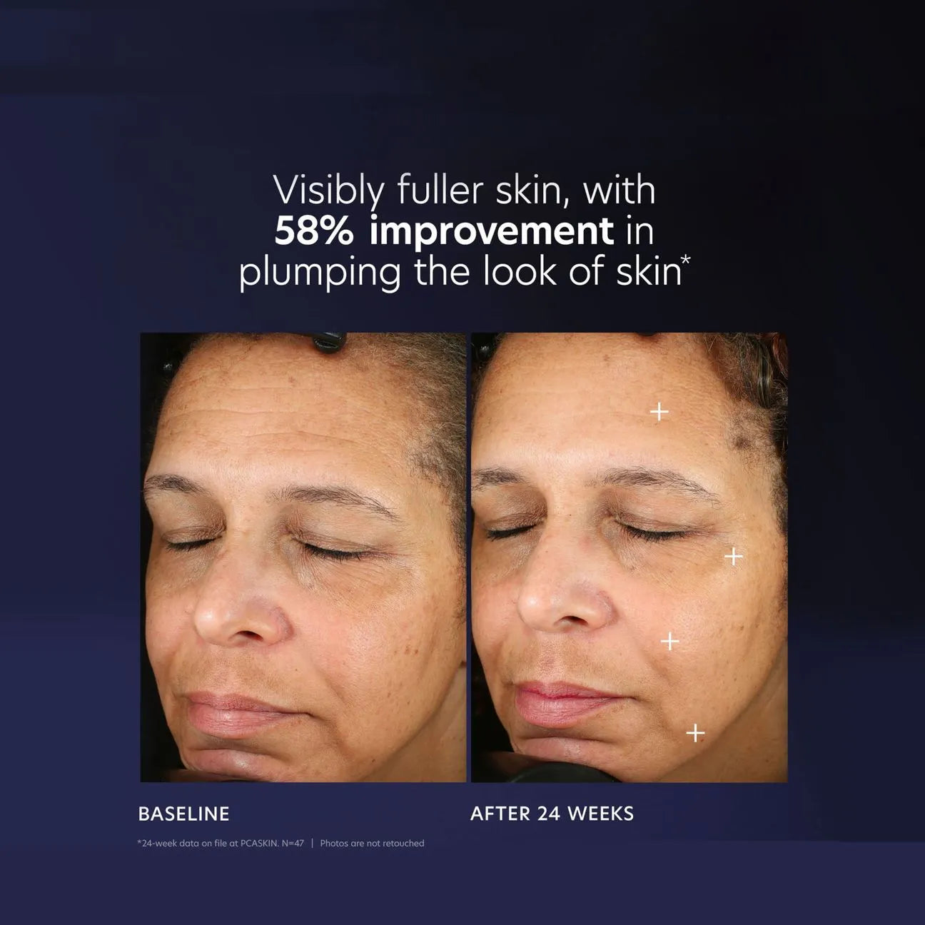 PCA Skin Pro-Max Age Renewal 1 oz.