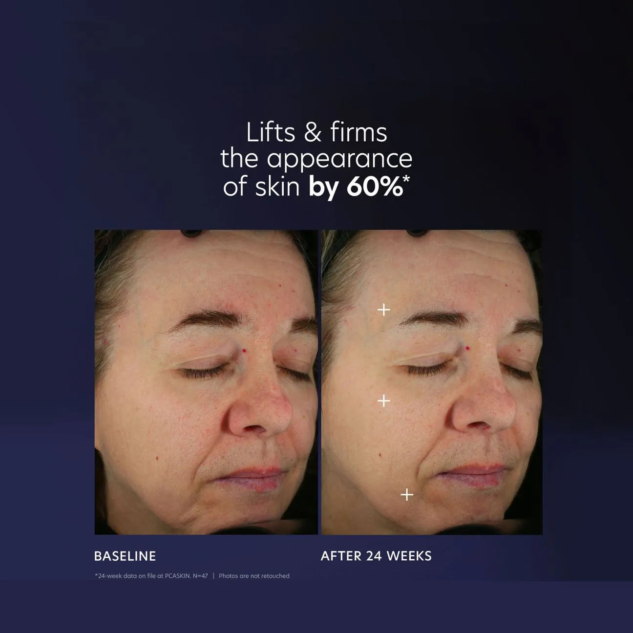 PCA Skin Pro-Max Age Renewal 1 oz.