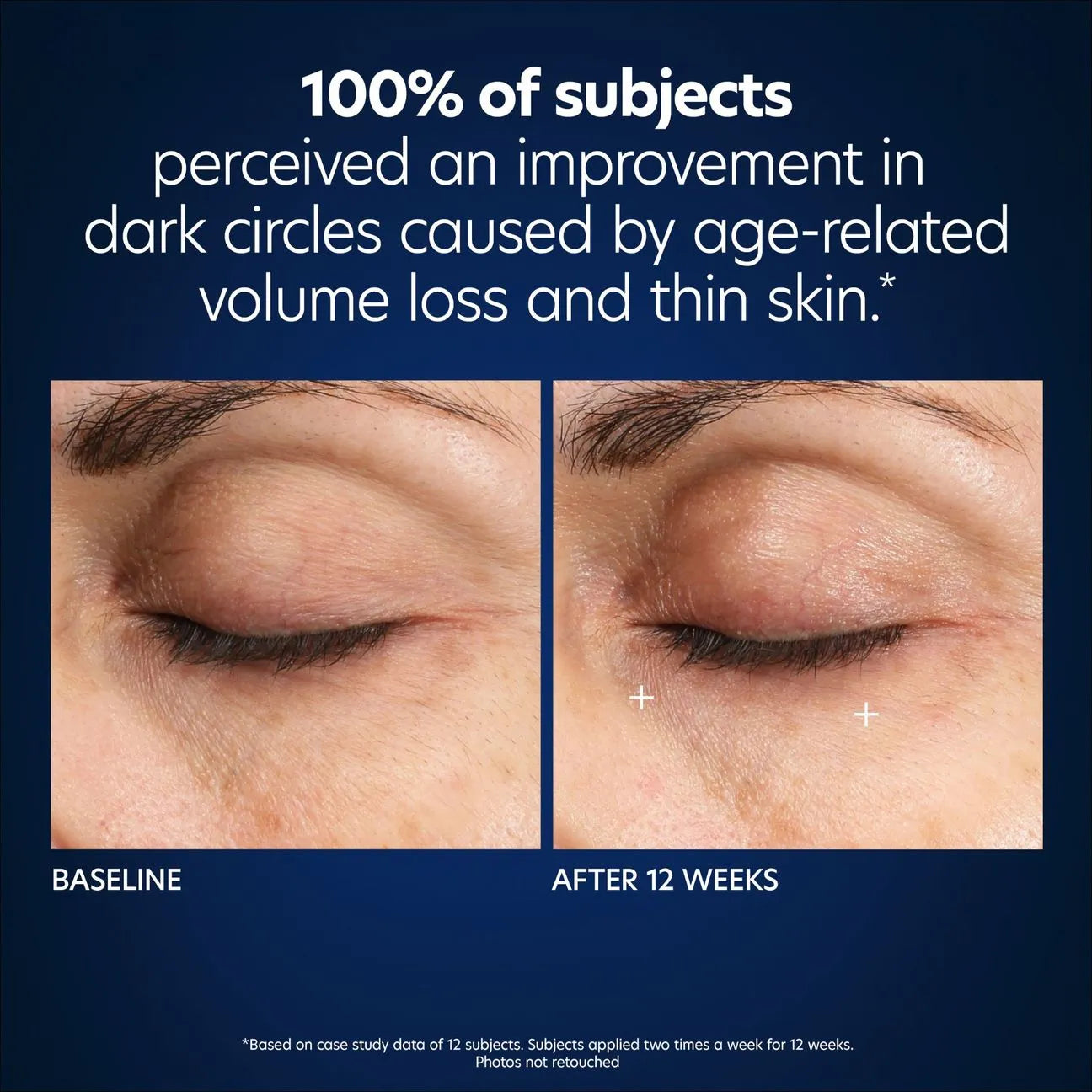 PCA Skin Hyaluronic Acid Microneedle Eye Patches 4 pack